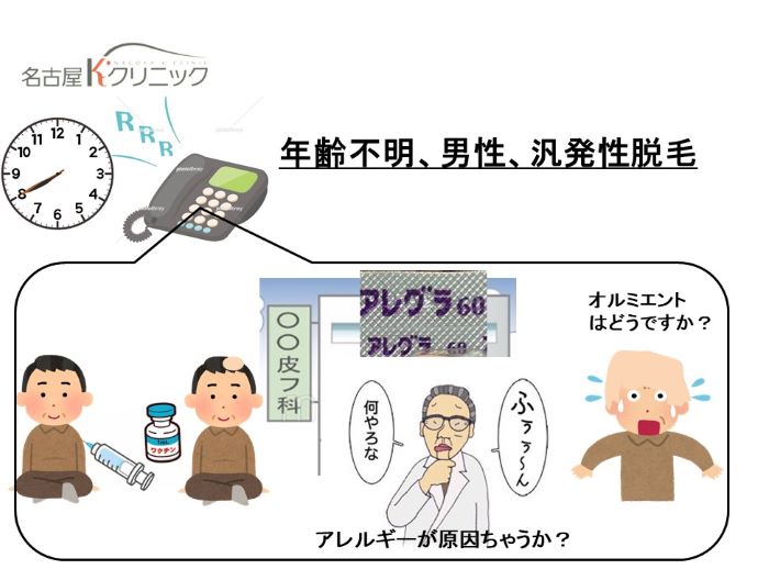 円形脱毛症　病院